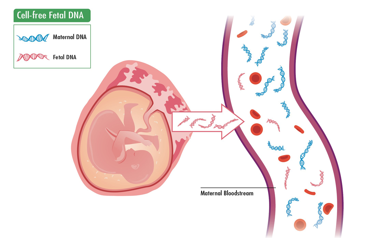 Cell-free DNA screening for prenatal detection